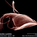 Lamblija_foto